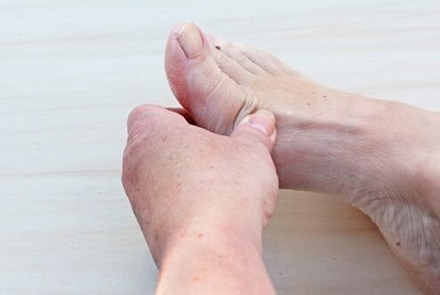 Arthrose des Fußes