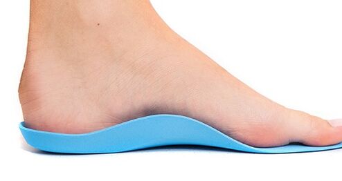 Einlagen bei Arthrose des Fußes