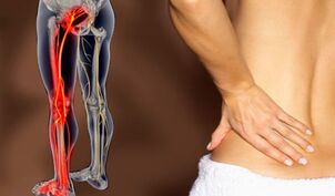 Merkmale von Rückenschmerzen