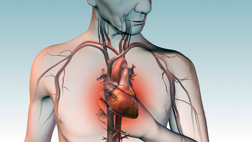 Schmerzen unter dem Schulterblatt und drückende Schmerzen hinter dem Brustbein bei Herzerkrankungen